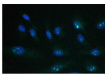 PARN Mouse Monoclonal Antibody