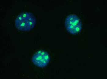 PARN Mouse Monoclonal Antibody