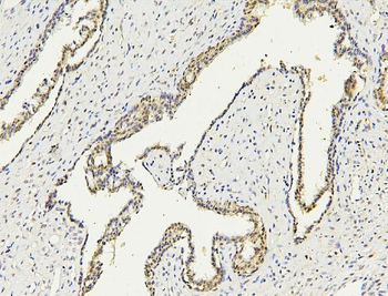 PARN Mouse Monoclonal Antibody