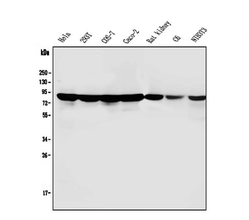 PARN Mouse Monoclonal Antibody