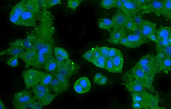 CA2 Mouse Monoclonal Antibody