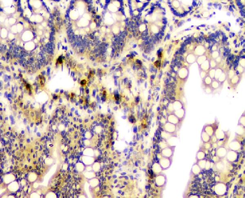 CA2 Mouse Monoclonal Antibody