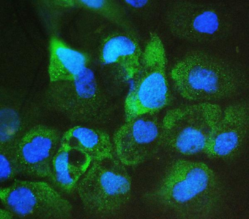 ARA9/AIP Mouse Monoclonal Antibody