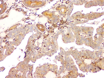 ARA9/AIP Mouse Monoclonal Antibody