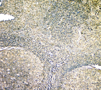 ARA9/AIP Mouse Monoclonal Antibody