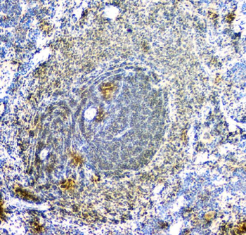ARA9/AIP Mouse Monoclonal Antibody