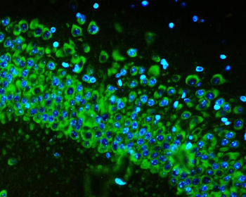 RPS6 Mouse Monoclonal Antibody