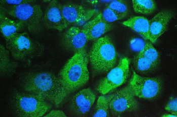 Galectin 3/LGALS3 Mouse Monoclonal Antibody
