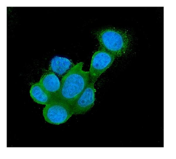 Galectin 3/LGALS3 Mouse Monoclonal Antibody