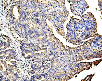 Galectin 3/LGALS3 Mouse Monoclonal Antibody