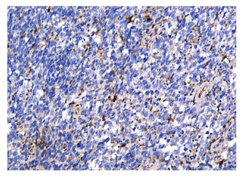 Galectin 3/LGALS3 Mouse Monoclonal Antibody