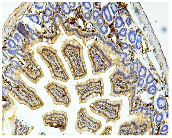 Galectin 3/LGALS3 Mouse Monoclonal Antibody