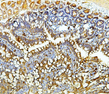 Galectin 3/LGALS3 Mouse Monoclonal Antibody
