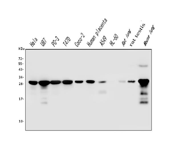 Galectin 3/LGALS3 Mouse Monoclonal Antibody