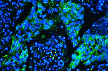 Caveolin-1/CAV1 Mouse Monoclonal Antibody