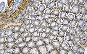 Caveolin-1/CAV1 Mouse Monoclonal Antibody