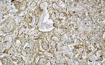 Caveolin-1/CAV1 Mouse Monoclonal Antibody