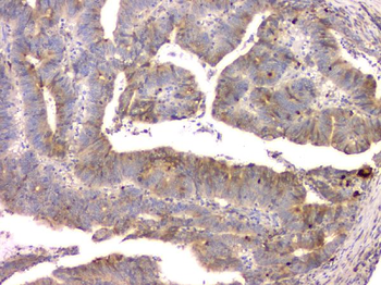 Cystatin C/CST3 Mouse Monoclonal Antibody