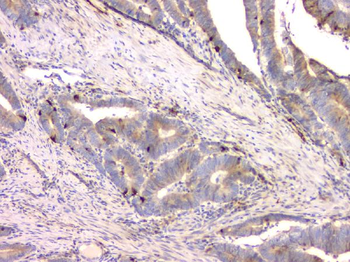 Cystatin C/CST3 Mouse Monoclonal Antibody