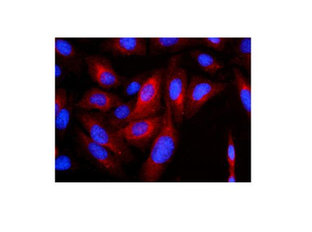 Cytokeratin 8 KRT8 Mouse Monoclonal Antibody