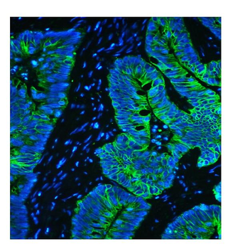 Cytokeratin 8 KRT8 Mouse Monoclonal Antibody