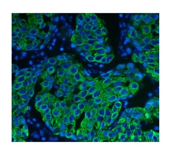 Cytokeratin 8 KRT8 Mouse Monoclonal Antibody