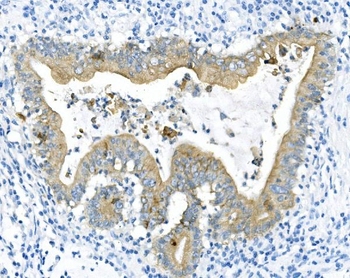 Cytokeratin 8 KRT8 Mouse Monoclonal Antibody