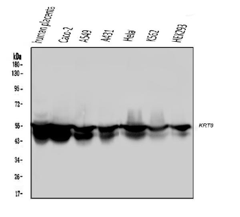 Cytokeratin 8 KRT8 Mouse Monoclonal Antibody