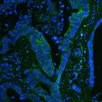 GPX1 Mouse Monoclonal Antibody
