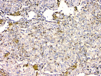 GPX1 Mouse Monoclonal Antibody