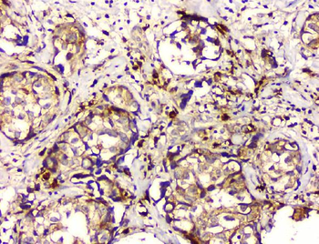 GPX1 Mouse Monoclonal Antibody