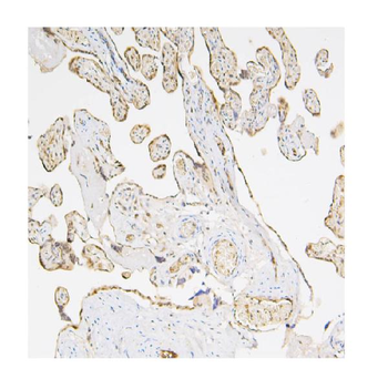 Caspase-3 Mouse Monoclonal Antibody