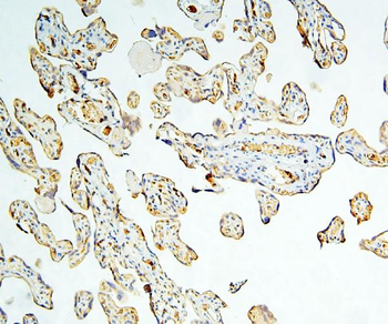 Caspase-3 Mouse Monoclonal Antibody