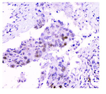 HAUSP/USP7 Mouse Monoclonal Antibody