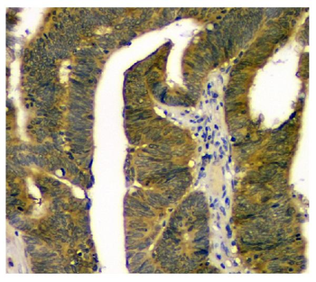 STUB1 Mouse Monoclonal Antibody