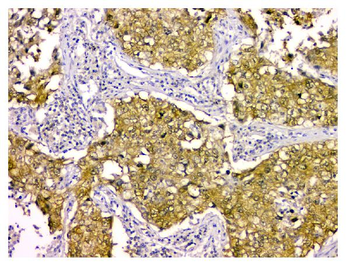 STUB1 Mouse Monoclonal Antibody