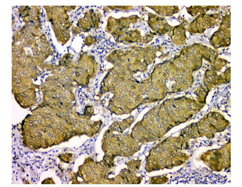 STUB1 Mouse Monoclonal Antibody