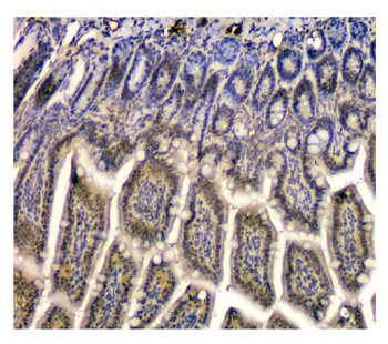 STUB1 Mouse Monoclonal Antibody