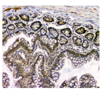 STUB1 Mouse Monoclonal Antibody