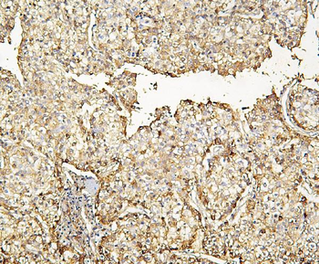 Haptoglobin/HP Rabbit Polyclonal Antibody