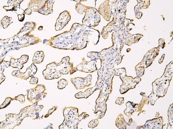 Haptoglobin/HP Rabbit Polyclonal Antibody