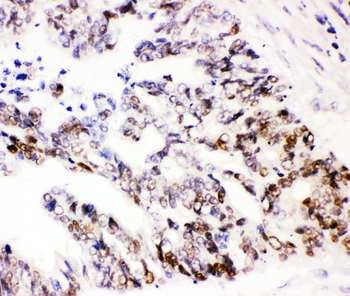 SOX9 Rabbit Polyclonal Antibody