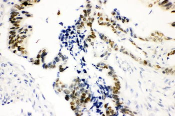 SOX9 Rabbit Polyclonal Antibody