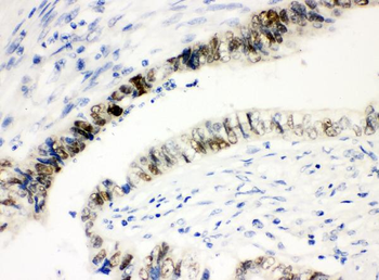 SOX9 Rabbit Polyclonal Antibody