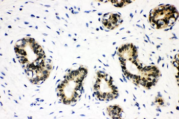 SOX9 Rabbit Polyclonal Antibody