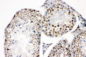 SOX9 Rabbit Polyclonal Antibody