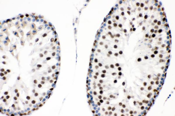 SOX9 Rabbit Polyclonal Antibody