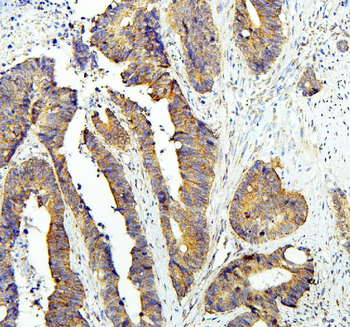Zinc finger protein GLI2 GLI2 Rabbit Polyclonal Antibody