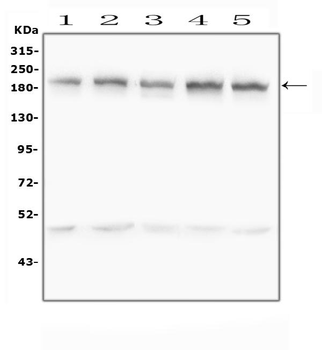 Zinc finger protein GLI2 GLI2 Rabbit Polyclonal Antibody