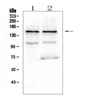 KCNH2 Rabbit Polyclonal Antibody